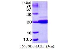 Image no. 1 for Nicotinamide Riboside Kinase 1 (NMRK1) protein (His tag) (ABIN1098295)