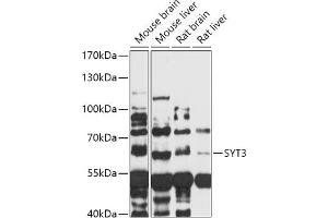 Western blot analysis of extracts of various cell lines, using SYT3 antibody (ABIN7270674) at 1:1000 dilution. (Synaptotagmin 3 antibody  (AA 449-590))