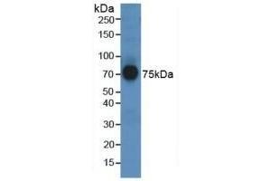 Detection of AFM in Human Serum using Polyclonal Antibody to Afamin (AFM) (Afamin antibody  (AA 211-403))