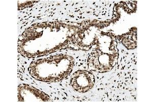 IHC analysis of TET1 using anti TET1 antibody (ABIN7600442). (TET1 antibody  (AA 194-417))