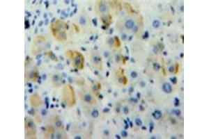 Used in DAB staining on fromalin fixed paraffin-embedded Liver tissue (alpha 1 Adrenergic Receptor antibody  (AA 330-466))