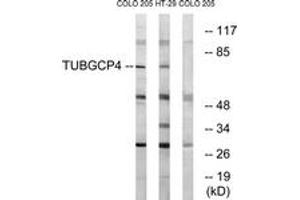 Western blot analysis of extracts from COLO/HT-29 cells, using TUBGCP4 Antibody. (TUBGCP4 antibody  (AA 191-240))