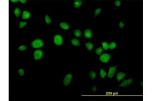 Immunofluorescence of monoclonal antibody to USP14 on HeLa cell. (USP14 antibody  (AA 395-494))