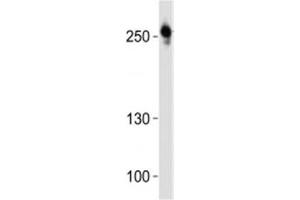 Western blot analysis of lysate from U-87 MG cell line using ROS1 antibody at 1:1000. (ROS1 antibody  (C-Term))