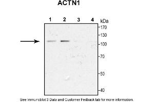 Sample Type: 1. (ACTN1 antibody  (N-Term))