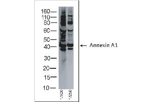 Rabbit anti Annexin A1 on human tonsil lysate (Annexin a1 antibody)