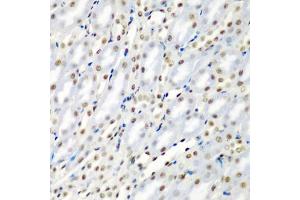 Immunohistochemistry of paraffin-embedded mouse kidney using SF3B3/S antibody (ABIN6128696, ABIN6147668, ABIN6147669 and ABIN6221751) at dilution of 1:200 (40x lens). (SF3B3 antibody  (AA 948-1217))