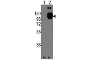 Image no. 1 for anti-Cadherin 13 (CDH13) (C-Term) antibody (ABIN356921) (Cadherin 13 antibody  (C-Term))