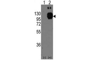 Image no. 1 for anti-Cadherin 13 (CDH13) (C-Term) antibody (ABIN356921) (Cadherin 13 antibody  (C-Term))