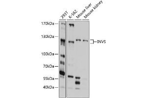 Western blot analysis of extracts of various cell lines, using INVS antibody (ABIN6129042, ABIN6142498, ABIN6142499 and ABIN6214498) at 1:1000 dilution. (Inversin antibody  (AA 1-90))