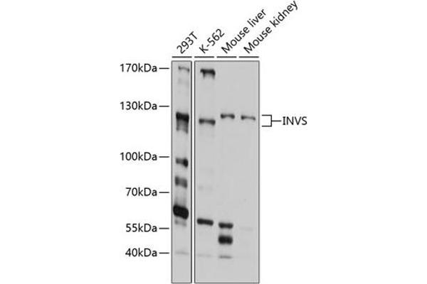 Inversin antibody  (AA 1-90)