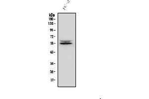 Western blot analysis of IRF3 using anti-IRF3 antibody (ABIN7601885).