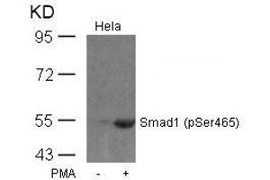 Western blot analysis of extracts from Hela cells untreated or treated with PMA using Smad1(Phospho-Ser465) Antibody. (SMAD1 antibody  (pSer465))