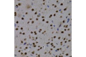 Immunohistochemistry (IHC) image for anti-Myocyte Enhancer Factor 2C (MEF2C) (AA 170-380) antibody (ABIN3023394)