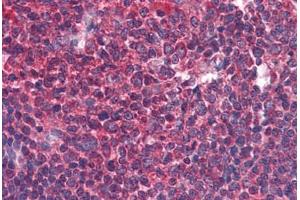 Human Tonsil: Formalin-Fixed, Paraffin-Embedded (FFPE) (BIRC3 antibody  (AA 314-508))