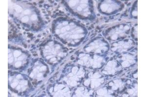 DAB staining on IHC-P; Samples: Mouse Colon Tissue (HNRNPA1 antibody  (AA 2-320))