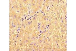 Immunohistochemistry of paraffin-embedded human liver tissue using ABIN7160996 at dilution of 1:100