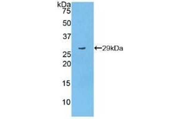 PARP1 antibody  (AA 661-881)