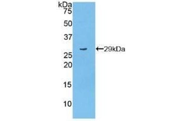 PARP1 Antikörper  (AA 661-881)