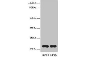 Western blot All lanes: CXXC4antibody at 3. (CXXC4 antibody  (AA 1-198))
