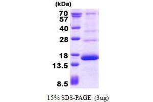 Image no. 1 for Hemoglobin, gamma G (HBG2) protein (His tag) (ABIN1098524)