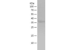 Western Blotting (WB) image for ADAM Metallopeptidase Domain 17 (ADAM17) (AA 752-824) protein (His-IF2DI Tag) (ABIN7282123) (ADAM17 Protein (AA 752-824) (His-IF2DI Tag))