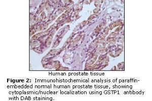 Image no. 1 for anti-Glutathione S-Transferase pi 1 (GSTP1) antibody (ABIN207627) (GSTP1 antibody)