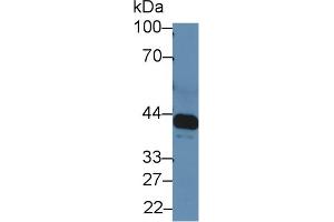 Western blot analysis of Rat Serum, using Rat IL6R Antibody (5 µg/ml) and HRP-conjugated Goat Anti-Rabbit antibody (