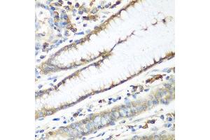 Immunohistochemistry of paraffin-embedded human stomach using CAD antibody. (CAD antibody  (AA 1650-1900))
