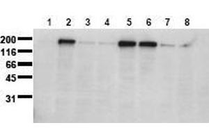 Western Blotting (WB) image for anti-Epidermal Growth Factor Receptor (EGFR) (pSer1071) antibody (ABIN126767) (EGFR antibody  (pSer1071))