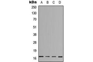 Western blot analysis of IL-3 expression in HeLa (A), Jurkat (B), Raw264. (IL-3 antibody  (Center))