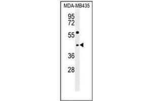 Western blot analysis of ABHD9 Antibody (C-term) in MDA-MB435 cell line lysates (35ug/lane). (ABHD9 antibody  (C-Term))