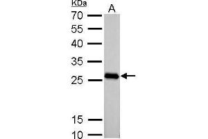 WB Image PGAM2 antibody detects PGAM2 protein by Western blot analysis. (PGAM2 antibody)