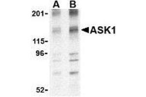 Western blot analysis of ASK1 in 3T3 cell lysate with AP30087PU-N ASK1 antibody at (A) 1 and (B) 2 μg/ml.