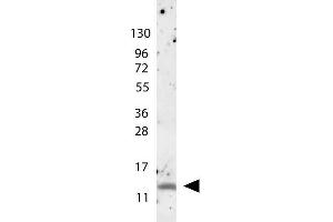 anti-Human MIP-1ß antibody shows detection of a band ~15 kDa in size corresponding to recombinant human MIP-1ß. (CCL4 antibody)