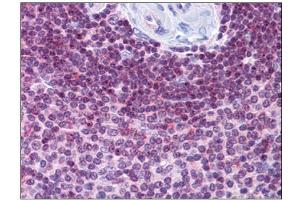 Human Spleen: Formalin-Fixed, Paraffin-Embedded (FFPE) (HVCN1 antibody  (C-Term))