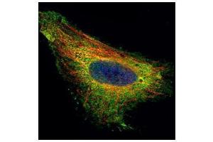 ICC/IF Image Confocal immunofluorescence analysis (Olympus FV10i) of paraformaldehyde-fixed HeLa, using TIP30, antibody (Green) at 1:500 dilution. (HIV-1 Tat Interactive Protein 2, 30kDa (HTATIP2) antibody)