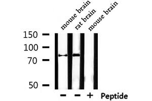 Western blot analysis of extracts from mouse brain,rat brain, using Mitofusin Antibody. (MFN1 antibody  (Internal Region))