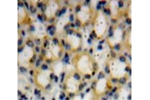 Used in DAB staining on fromalin fixed paraffin-embedded Kidney tissue (Dymeclin antibody  (AA 546-669))