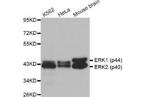 Western blot analysis of extracts of various cell lines, using ERK1/2 antibody. (ERK2 antibody  (AA 200-300))