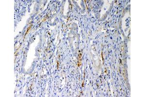 IHC analysis of VEGFD using anti-VEGFD antibody . (VEGFD antibody  (AA 89-205))