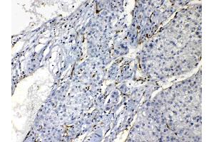 Immunohistochemistry (IHC) image for anti-Purine Nucleoside Phosphorylase (PNP) (AA 161-189), (Middle Region) antibody (ABIN4886701)