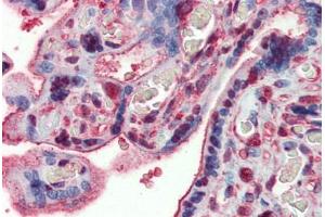 Human Placenta: Formalin-Fixed, Paraffin-Embedded (FFPE) (GAPDH antibody  (AA 9-323))