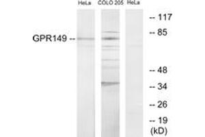 Western blot analysis of extracts from HeLa/COLO205 cells, using GPR149 Antibody. (GPR149 antibody  (AA 451-500))
