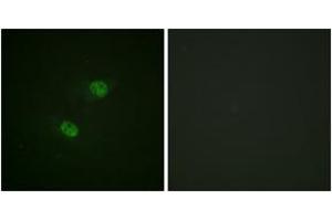 Immunofluorescence analysis of HeLa cells, using CDC16/APC6 (Phospho-Ser560) Antibody. (CDC16 antibody  (pSer560))