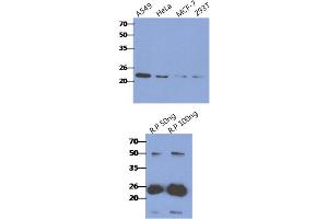 anti-CASP2 and RIPK1 Domain Containing Adaptor with Death Domain (CRADD) (AA 1-199) antibody