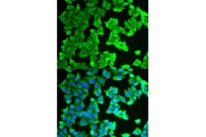 Immunofluorescence analysis of HeLa cells using RPLP0 antibody (ABIN6128685, ABIN6147162, ABIN6147164 and ABIN6217707). (RPLP0 antibody  (AA 1-317))