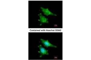 ICC/IF Image Immunofluorescence analysis of methanol-fixed HeLa, using RIP2, antibody at 1:200 dilution. (RIPK2 antibody)