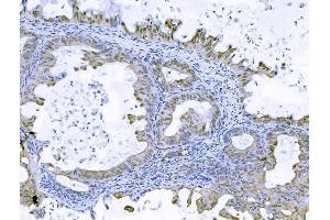 IHC analysis of FOXK1 using anti-FOXK1 antibody (ABIN7600295). (Foxk1 antibody  (AA 175-671))