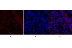Immunofluorescence analysis of rat lung tissue. (SMAD2 antibody)